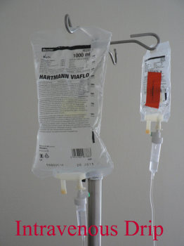 Intravenous Drip Treatment